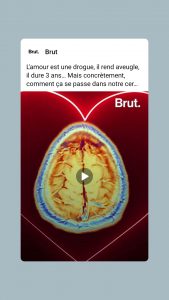 Cerveau